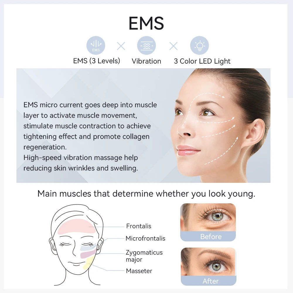 ANLAN EMS Facial Massager Pro Face Lifting Skin Rejuvenation Cold Compress Deep Cleaning Anti-aging Skincare Beauty Device