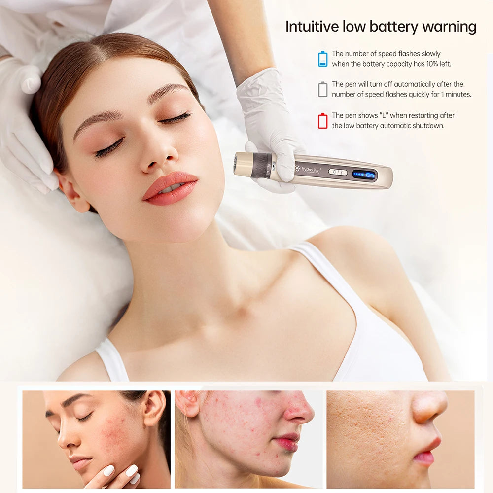 New  EMS Microcurrent Hydra Pen H5 Mesotherapy Automatical Serum Applicator Beauty & Care Derma Microneedling Pen