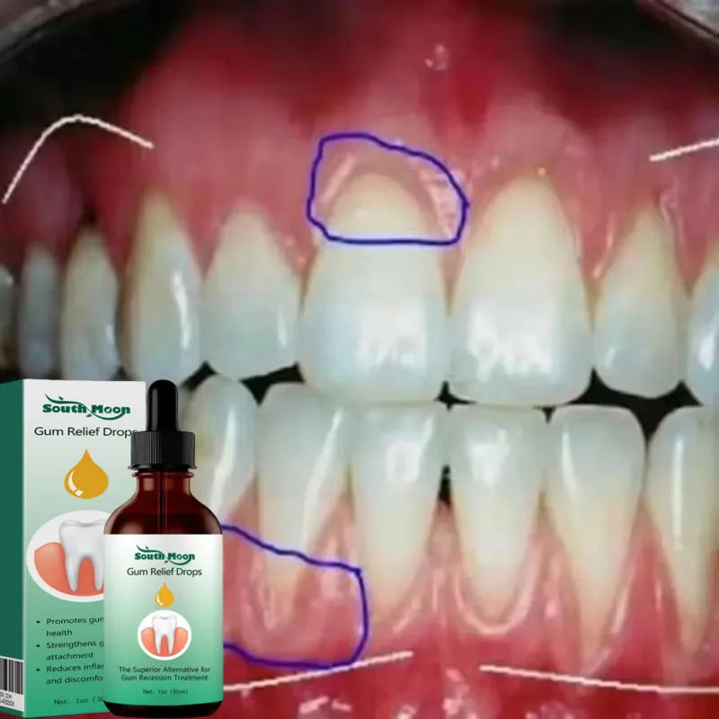 Gum Repair Serum Drops Relieve Receding Gum Periodontal Yellow Treatment Pharyngitis Oral Pain Cleaning Antibacteria Teeth Care